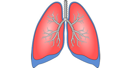 Illustration of Pulmonary Disease