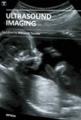 Small book cover: Ultrasound Imaging