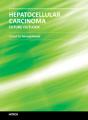 Small book cover: Hepatocellular Carcinoma