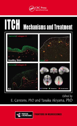 Large book cover: Itch: Mechanisms and Treatment