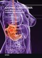 Book cover: Gastric Carcinoma: New Insights into Current Management